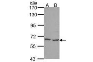 Image no. 1 for anti-Polynucleotide Kinase 3'-Phosphatase (PNKP) (AA 1-243) antibody (ABIN467497) (PNKP 抗体  (AA 1-243))
