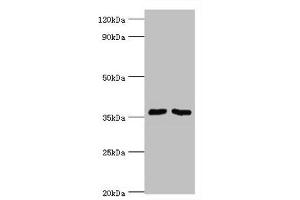 Western blot All lanes: Methylosome protein 50 antibody at 6 μg/mL Lane 1: Hela whole cell lysate Lane 2: HepG2 whole cell lysate Secondary Goat polyclonal to rabbit IgG at 1/10000 dilution Predicted band size: 37, 30 kDa Observed band size: 37 kDa (WDR77 抗体  (AA 1-260))