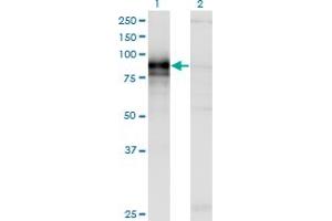 Western Blotting (WB) image for anti-Hedgehog Interacting Protein (HHIP) (AA 21-120) antibody (ABIN566261)