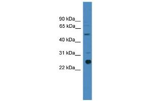 WB Suggested Anti-ZMAT2 Antibody Titration:  0. (ZMAT2 抗体  (Middle Region))