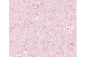 Immunohistochemistry (IHC) image for anti-CXXC Finger Protein 4 (CXXC4) (N-Term) antibody (ABIN1031338)