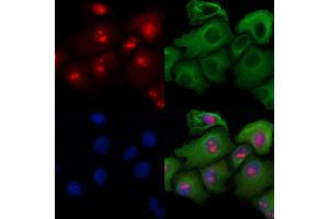 ABIN6258822 and ABIN6274418 staining Hela cells by IF/ICC. (MAP4K3 抗体  (N-Term))