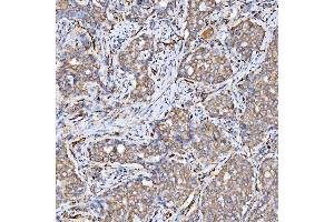 IHC analysis of SRPRB using anti-SRPRB antibody (ABIN7602015). (SRPRB 抗体  (AA 55-271))