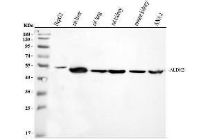 Western blot analysis of ALDH2 using anti-ALDH2 antibody (ABIN3043782).