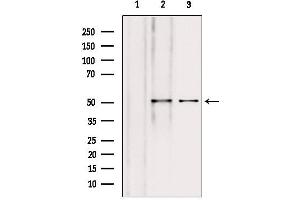 Western blot analysis of extracts from various samples, using NAPRT1 antibody. (NAPRT1 抗体  (Internal Region))