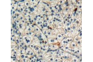 Used in DAB staining on fromalin fixed paraffin-embedded kidney cancer tissue (FAS 抗体  (AA 21-170))