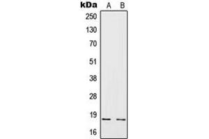 Western blot analysis of IL-4 expression in HeLa (A), Raji (B) whole cell lysates. (IL-4 抗体  (Center))