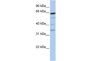 WB Suggested Anti-GALNTL1 Antibody Titration:  0. (GALNTL1 抗体  (N-Term))