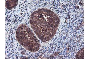 Image no. 1 for anti-Kelch-Like ECH-Associated Protein 1 (KEAP1) antibody (ABIN1499016) (KEAP1 抗体)