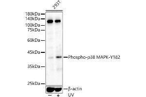 Western blot analysis of extracts of various cell lines, using Phospho-p38 MAPK-Y182 antibody (ABIN3023585, ABIN3023586, ABIN3023587 and ABIN6225421) at 1:500 dilution. (MAPK14 抗体  (pTyr182))
