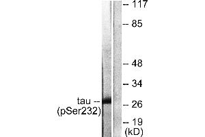 Immunohistochemistry analysis of paraffin-embedded human pancreas tissue using 14-3-3 θ/τ (Phospho-Ser232) antibody. (14-3-3 theta 抗体  (pSer232))