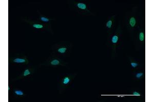 Immunofluorescence of purified MaxPab antibody to MCM5 on HeLa cell. (MCM5 抗体  (AA 1-734))