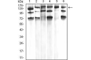 Western Blotting (WB) image for anti-phospholipase C, gamma 1 (PLCG1) (AA 1192-1291) antibody (ABIN5933333) (Phospholipase C gamma 1 抗体  (AA 1192-1291))