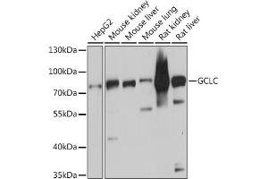 Western blot analysis of extracts of various cell lines, using GCLC antibody (ABIN6130444, ABIN6141016, ABIN6141017 and ABIN6214615) at 1:3000 dilution. (GCLC 抗体  (AA 1-252))