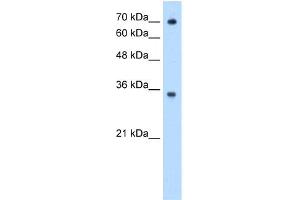 WB Suggested Anti-FCGRT Antibody Titration:  0. (FcRn 抗体  (N-Term))