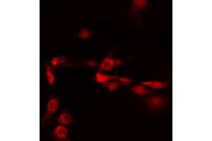ABIN6272260 staining LOVO by IF/ICC. (C/EBP delta/epsilon 抗体)