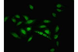 Immunofluorescent analysis of Hela cells using ABIN7176113 at dilution of 1:100 and Alexa Fluor 488-congugated AffiniPure Goat Anti-Rabbit IgG(H+L) (ZNF133 抗体  (AA 1-210))