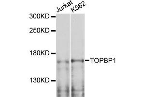 Western blot analysis of extracts of various cell lines, using TOPBP1 antibody. (TOPBP1 抗体)