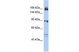 WB Suggested Anti-AFF2 Antibody Titration:  0. (AFF2 抗体  (N-Term))