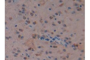 IHC-P analysis of Mouse Cerebrum Tissue, with DAB staining. (MST1 抗体  (AA 469-704))