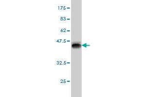 Western Blot detection against Immunogen (37. (Myopalladin 抗体  (AA 61-170))