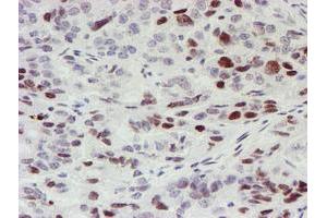Image no. 1 for anti-Myeloid Leukemia Factor 1 (MLF1) antibody (ABIN1499495) (MLF1 抗体)
