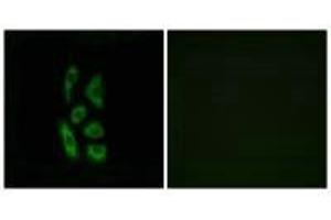 Immunofluorescence analysis of A549 cells, using ACOT12 antibody. (ACOT12 抗体)