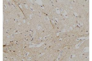ABIN6257183 and ABIN6274545 at 1/100 staining Human brain tissue by IHC-P. (FOXD3 抗体  (Internal Region))