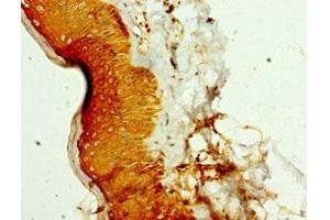 Immunohistochemistry of paraffin-embedded human skin tissue using ABIN7169410 at dilution of 1:100 (SMYD4 抗体  (AA 1-260))