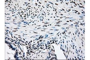 Immunohistochemical staining of paraffin-embedded pancreas tissue using anti-BRAFmouse monoclonal antibody. (BRAF 抗体)
