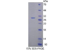 SDS-PAGE analysis of Rat BAG5 Protein.