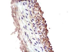 Formalin-fixed and paraffin embedded rat carotid artery Anti-MMP-2 Polyclonal Antibody , Unconjugated at 1:200, followed by conjugation to the secondary antibody and DAB staining. (MMP2 抗体  (AA 31-109))