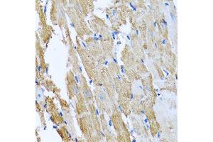 Immunohistochemistry of paraffin-embedded rat heart using CCM2 antibody. (CCM2 抗体  (AA 1-300))