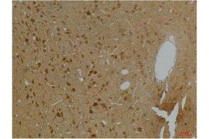 Immunohistochemistry (IHC) image for anti-Potassium Voltage-Gated Channel, Subfamily H (Eag-Related), Member 5 (KCNH5) antibody (ABIN3188070)