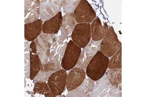 Immunohistochemical staining of human skeletal muscle with ANKRD2 polyclonal antibody  shows strong cytoplasmic positivity in myocytes at 1:500-1:1000 dilution. (ANKRD2 抗体)