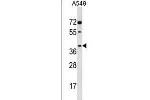 Western Blotting (WB) image for anti-Aldo-Keto Reductase Family 1, Member E2 (AKR1E2) (AA 291-320), (C-Term) antibody (ABIN1537068)