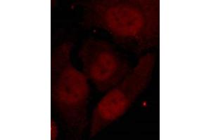 Immunofluorescence staining of methanol-fixed Hela cells showing nuclear staining using HDAC2(Phospho-Ser394) Antibody. (HDAC2 抗体  (pSer394))