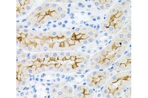 Immunohistochemistry of paraffin-embedded Mouse kidney using IL17A Polyclonal Antibody at dilution of 1:100 (40x lens). (Interleukin 17a 抗体)