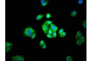 Immunofluorescence staining of HepG2 cells with ABIN7143641 at 1:66, counter-stained with DAPI. (ADH1A 抗体  (AA 104-253))