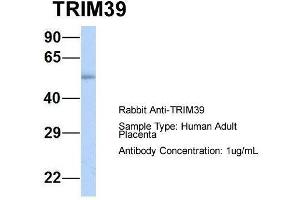 Host:  Rabbit  Target Name:  TRIM39  Sample Type:  Human Adult Placenta  Antibody Dilution:  1. (TRIM39 抗体  (Middle Region))