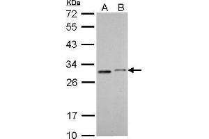 Western Blotting (WB) image for anti-Succinate Dehydrogenase Complex, Subunit B, Iron Sulfur (Ip) (SDHB) (C-Term) antibody (ABIN2855873)