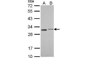 WB Image SDHB antibody [C2C3], C-term detects SDHB protein by Western blot analysis. (SDHB 抗体  (C-Term))