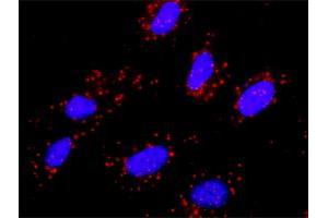 Proximity Ligation Analysis of protein-protein interactions between CBL and MET. (c-MET 抗体  (AA 1-1390))