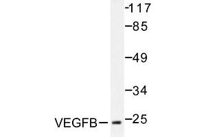 Image no. 1 for anti-Vascular Endothelial Growth Factor B (VEGFB) antibody (ABIN271976) (VEGFB 抗体)