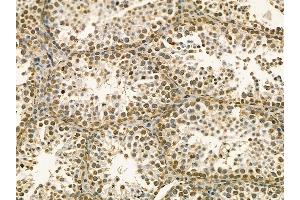 CAMKK1 Mouse Monoclonal Antibody at 1/100 staining mouse testis tissue by IHC-P. (CAMKK1 抗体  (C-Term))