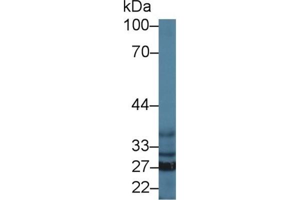SFXN1 抗体  (AA 2-102)