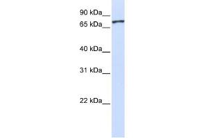 WB Suggested Anti-UNC5A Antibody Titration:  0. (UNC5A 抗体  (Middle Region))
