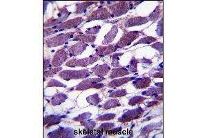MYOM1 Antibody (Center) (ABIN657367 and ABIN2846414) immunohistochemistry analysis in formalin fixed and paraffin embedded human skeletal muscle followed by peroxidase conjugation of the secondary antibody and DAB staining. (Myomesin 1 抗体  (AA 904-933))