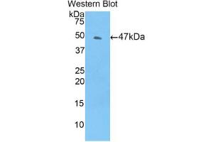 Western blot analysis of the recombinant protein. (TIMP4 抗体  (AA 10-170))