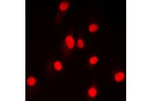 Immunofluorescent analysis of NF-kappaB p100 (pS865) staining in HepG2 cells. (NFKB2 抗体  (C-Term, pSer865))